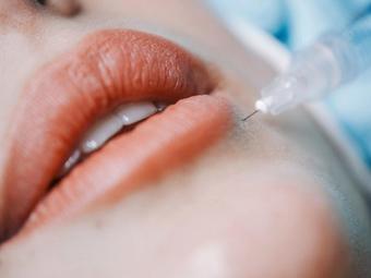 Увлажнение губ гиалуроновой кислотой